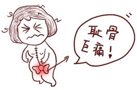 孕期耻骨疼生完会好吗（孕期耻骨疼生完会好吗）  第1张