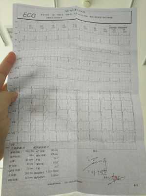 孕期心肌缺血会自愈吗(轻中度心肌缺血能治好吗) 第2张 孕期心肌缺血会自愈吗(轻中度心肌缺血能治好吗) 第2张
