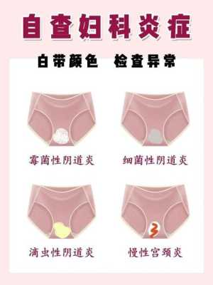 孕期分泌物发黄无异味(孕期分泌物发黄无异味不痒) 第1张 孕期分泌物发黄无异味(孕期分泌物发黄无异味不痒) 第1张