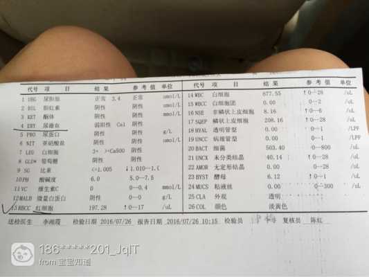 孕妇尿检白细胞3十严重吗,孕期尿白细胞3个加号 第1张 孕妇尿检白细胞3十严重吗,孕期尿白细胞3个加号 第1张