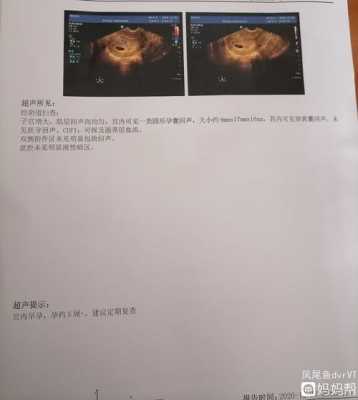 孕5周孕囊的大小是多少呢,孕期5周的孕囊大小是多少 第2张 孕5周孕囊的大小是多少呢,孕期5周的孕囊大小是多少 第2张