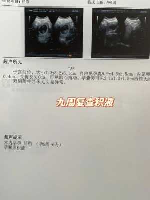 孕期宫腔积液怎样治疗(孕期宫腔积液怎样治疗快好) 第2张 孕期宫腔积液怎样治疗(孕期宫腔积液怎样治疗快好) 第2张