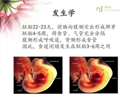 如何发现食管闭锁,胎儿食道闭锁的原因有哪些 第3张 如何发现食管闭锁,胎儿食道闭锁的原因有哪些 第3张