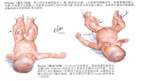 孕期阴阳腿是男宝吗(孕期阴阳腿孩子会有影响吗) 第1张 孕期阴阳腿是男宝吗(孕期阴阳腿孩子会有影响吗) 第1张