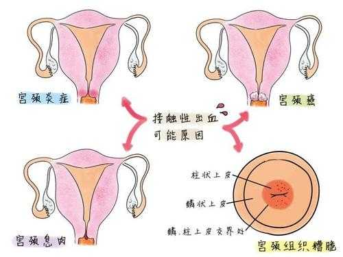 备孕期间出血什么情况（备孕期间出血什么情况啊）  第2张