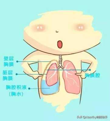 胎儿胸腔积液怎么办,如何让胎儿吸收积液呢 第2张 胎儿胸腔积液怎么办,如何让胎儿吸收积液呢 第2张