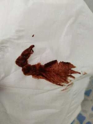 怀孕期间小便有血迹(孕39周,小便完后,用纸巾擦拭有血丝是什么原因啊?血不多) 第2张 怀孕期间小便有血迹(孕39周,小便完后,用纸巾擦拭有血丝是什么原因啊?血不多) 第2张
