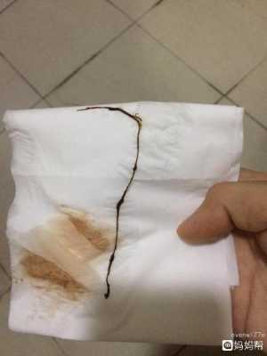 整个孕期断断续续出血(整个孕期断断续续出血带血丝) 第2张 整个孕期断断续续出血(整个孕期断断续续出血带血丝) 第2张