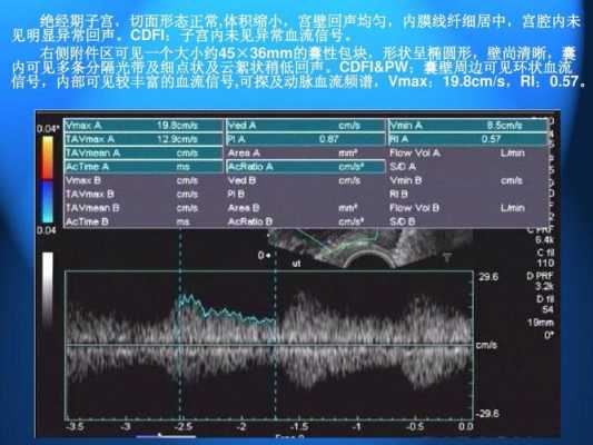 子宫肌瘤中CDFI:周边可见带状血流信号,孕妇宫腔内带状分隔 第1张 子宫肌瘤中CDFI:周边可见带状血流信号,孕妇宫腔内带状分隔 第1张
