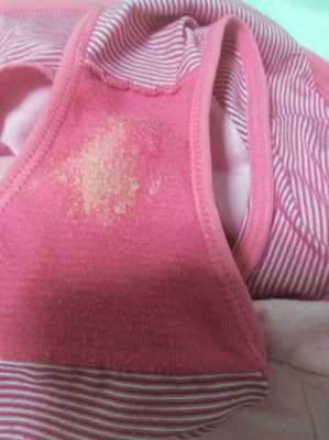 孕期白带黄绿色豆腐渣(孕期分泌物黄绿色豆腐渣) 第1张 孕期白带黄绿色豆腐渣(孕期分泌物黄绿色豆腐渣) 第1张