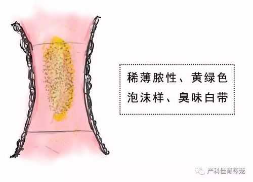 孕期外阴瘙痒分泌物多(孕期下面痒分泌物多) 第2张 孕期外阴瘙痒分泌物多(孕期下面痒分泌物多) 第2张