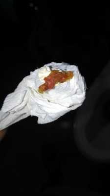 孕妇拉的屎是黑色的,这是怎么回事呢,怀孕期间大便是黑色的正常吗 第1张 孕妇拉的屎是黑色的,这是怎么回事呢,怀孕期间大便是黑色的正常吗 第1张