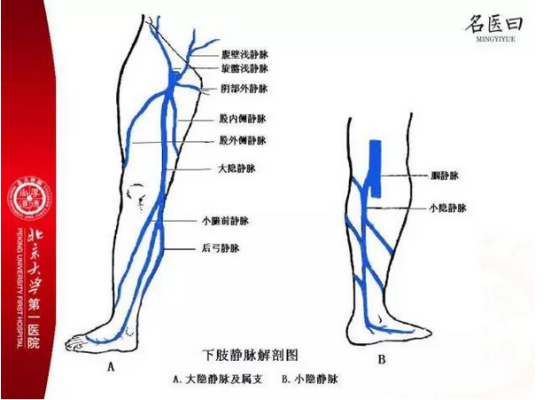 孕期外阴部静脉曲张图 第2张 孕期外阴部静脉曲张图 第2张