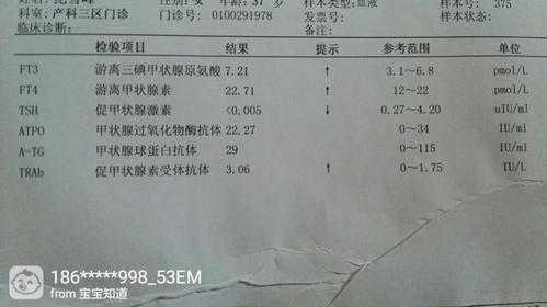 怀孕tsh偏低影响胎儿吗(怀孕期间tsh偏低会影响胎儿吗?) 第1张 怀孕tsh偏低影响胎儿吗(怀孕期间tsh偏低会影响胎儿吗?) 第1张