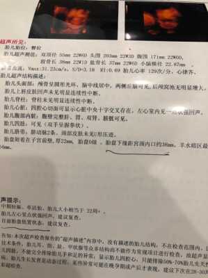 胎儿心率152是男孩女孩(胎儿心率152是男孩女孩啊) 第1张 胎儿心率152是男孩女孩(胎儿心率152是男孩女孩啊) 第1张