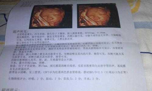 胎儿有强光点正常吗(四维彩超显示胎儿左心室有强光点什么意思) 第2张 胎儿有强光点正常吗(四维彩超显示胎儿左心室有强光点什么意思) 第2张