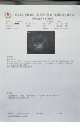 怀孕宫腔积液是是什么原因造成的怎么治,孕期宫腔积血怎么办能治好吗 第2张 怀孕宫腔积液是是什么原因造成的怎么治,孕期宫腔积血怎么办能治好吗 第2张