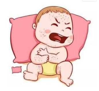 孕期吃什么预防新生儿湿疹(孕期吃什么预防新生儿湿疹复发) 第3张 孕期吃什么预防新生儿湿疹(孕期吃什么预防新生儿湿疹复发) 第3张