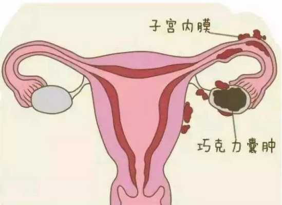 卵巢囊肿影响胎儿发育(卵巢囊肿影响胎儿发育吗) 第2张 卵巢囊肿影响胎儿发育(卵巢囊肿影响胎儿发育吗) 第2张