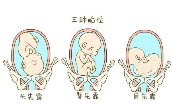 左骶横位胎儿图片(左骶横位胎儿图片) 第1张 左骶横位胎儿图片(左骶横位胎儿图片) 第1张