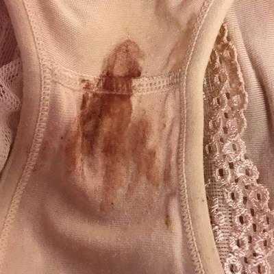 怀孕期间出血肚子不疼(怀孕期间出血肚子不疼是什么情况) 第3张 怀孕期间出血肚子不疼(怀孕期间出血肚子不疼是什么情况) 第3张