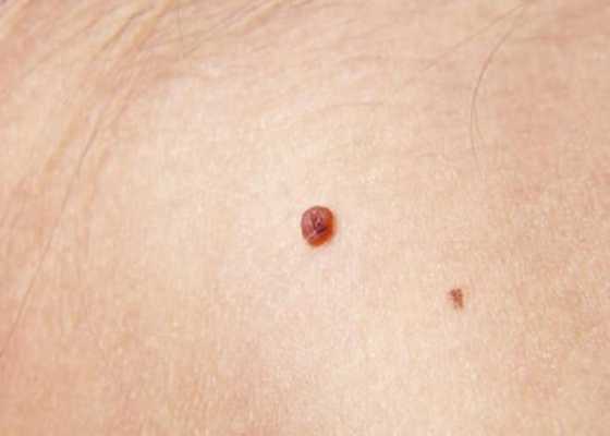 怀孕期间乳头有脏东西(怀孕期间乳头有脏东西怎么回事) 第2张 怀孕期间乳头有脏东西(怀孕期间乳头有脏东西怎么回事) 第2张