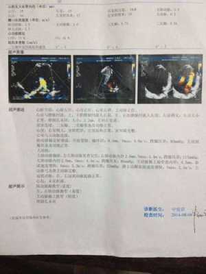 胎儿肺动脉与主动脉内径比例偏小是什么意思,胎儿主肺动脉比例异常的原因没事吧 第1张 胎儿肺动脉与主动脉内径比例偏小是什么意思,胎儿主肺动脉比例异常的原因没事吧 第1张