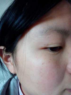 怀孕期间脸上长斑有什么好的办法可以除去或者淡化吗,怀孕期间长斑如何消除最快 第1张 怀孕期间脸上长斑有什么好的办法可以除去或者淡化吗,怀孕期间长斑如何消除最快 第1张