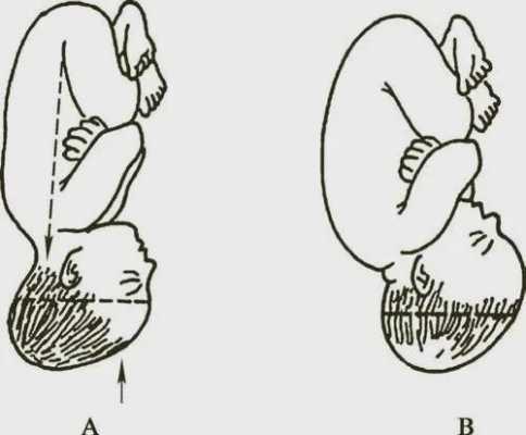 胎儿在母体内的姿势(胎儿在母体内怎么活动) 第3张 胎儿在母体内的姿势(胎儿在母体内怎么活动) 第3张