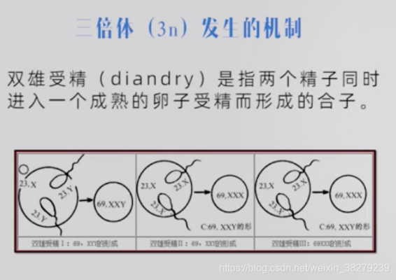 69三倍体胎儿（69三倍体胎儿XXY）  第1张