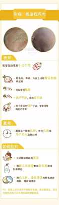 胎儿有胎毒怎么办(胎儿有胎毒怎么办啊) 第2张 胎儿有胎毒怎么办(胎儿有胎毒怎么办啊) 第2张