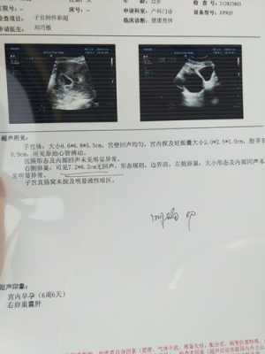怀孕期有囊肿怎么办(怀孕期有囊肿怎么办啊) 第1张 怀孕期有囊肿怎么办(怀孕期有囊肿怎么办啊) 第1张