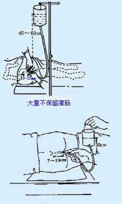 孕妇灌肠对胎儿的影响(孕妇灌肠对胎儿的影响) 第1张 孕妇灌肠对胎儿的影响(孕妇灌肠对胎儿的影响) 第1张