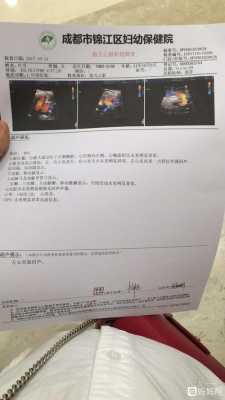 胎儿心脏灶状强回声(胎儿心脏灶状强回声) 第2张 胎儿心脏灶状强回声(胎儿心脏灶状强回声) 第2张