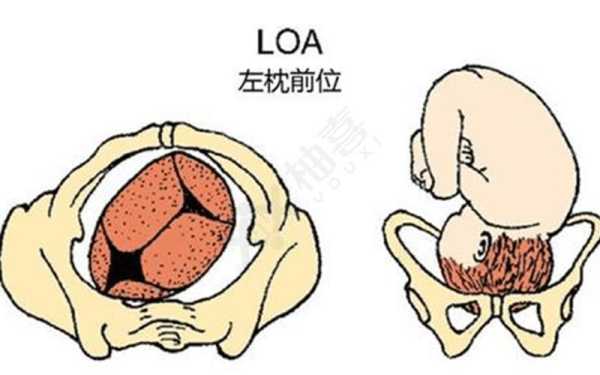 头位loa的胎儿图解(Lorael是什么意思) 第3张 头位loa的胎儿图解(Lorael是什么意思) 第3张