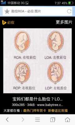 头位loa的胎儿图解(Lorael是什么意思) 第2张 头位loa的胎儿图解(Lorael是什么意思) 第2张