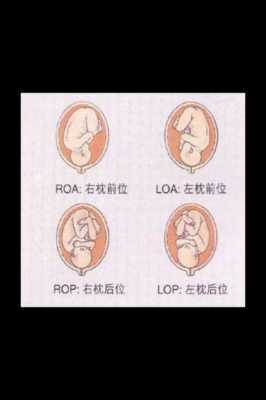 头位loa的胎儿图解(Lorael是什么意思) 第1张 头位loa的胎儿图解(Lorael是什么意思) 第1张