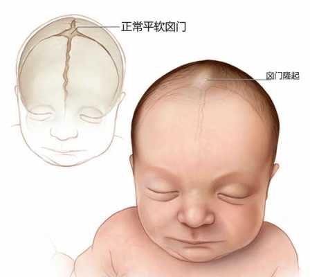 胎儿枕下前囟径(胎儿枕下前囟径的正常值是?) 第3张 胎儿枕下前囟径(胎儿枕下前囟径的正常值是?) 第3张