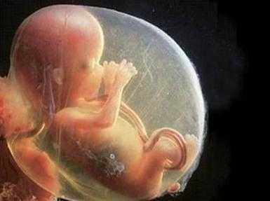 70天宝宝可以趴吗?多大开始锻炼最好呢,怀孕七十天胎儿图片 正常 第1张 70天宝宝可以趴吗?多大开始锻炼最好呢,怀孕七十天胎儿图片 正常 第1张