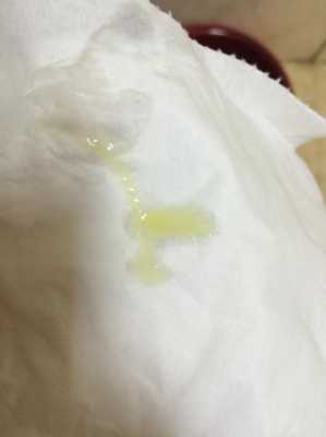 孕妇白带发黄对胎儿吗(孕妇白带发黄正常吗) 第2张 孕妇白带发黄对胎儿吗(孕妇白带发黄正常吗) 第2张