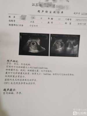 孕期四十天没胎心胎芽(怀孕42天还没有胎心胎芽,怎么办) 第1张 孕期四十天没胎心胎芽(怀孕42天还没有胎心胎芽,怎么办) 第1张