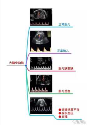 胎儿大脑中动脉意义(胎儿大脑中动脉意义主要看哪个数) 第2张 胎儿大脑中动脉意义(胎儿大脑中动脉意义主要看哪个数) 第2张