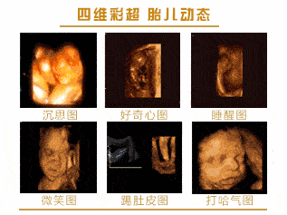 孕期大排畸和四维区别(孕期大排畸和四维区别大吗) 第1张 孕期大排畸和四维区别(孕期大排畸和四维区别大吗) 第1张