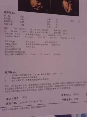 胎儿脑动脉正常值(胎儿脑动脉正常值是多少) 第2张 胎儿脑动脉正常值(胎儿脑动脉正常值是多少) 第2张