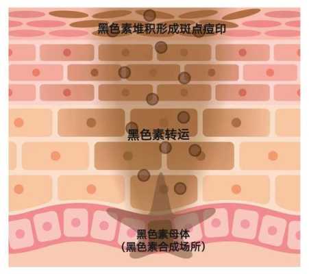 怀孕时的黑色素多久可以消,孕期黑色素什么时候能褪掉  第2张