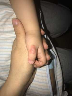 宝宝总吸吮手指是什么情况?宝宝快三个月了,发育不好吗,胎儿在肚子里吃手指会影响面容发育吗 第3张 宝宝总吸吮手指是什么情况?宝宝快三个月了,发育不好吗,胎儿在肚子里吃手指会影响面容发育吗 第3张