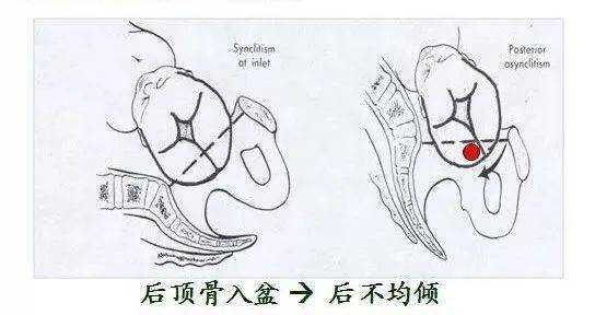 胎儿左枕横位图片（怀孕七个月横位怎么办？我该为宝宝做的措施是什么）  第3张
