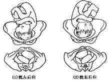 胎儿左枕横位图片（怀孕七个月横位怎么办？我该为宝宝做的措施是什么）  第1张