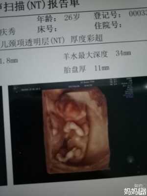 胎儿和母亲面对面 第2张 胎儿和母亲面对面 第2张