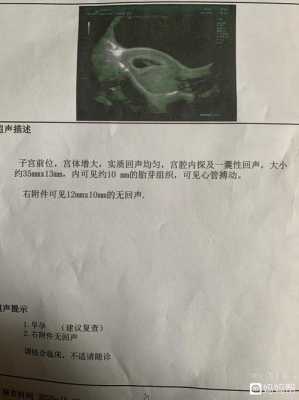 宫腔内囊性回声什么意思,胎儿右下腹囊性回声严重吗  第2张